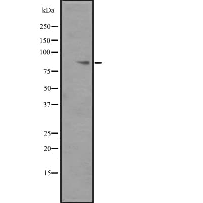 Polyclonal Rabbit anti-Human ITGB6 / Integrin Beta 6 Antibody (WB)
