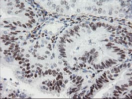 TLE1 / TLE 1 Antibody (clone OTI3C9)