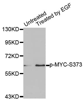 Polyclonal Rabbit anti-Human MYC / c-Myc Antibody (phospho-Ser373, WB)