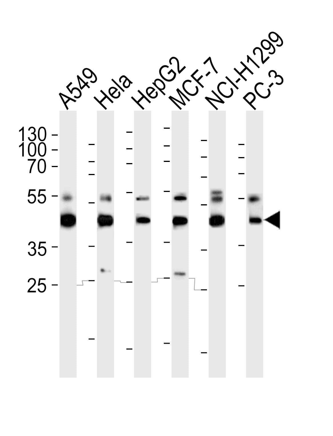 Polyclonal Rabbit anti-Human INHBA / Inhibin Beta A Antibody (aa377-410, WB)