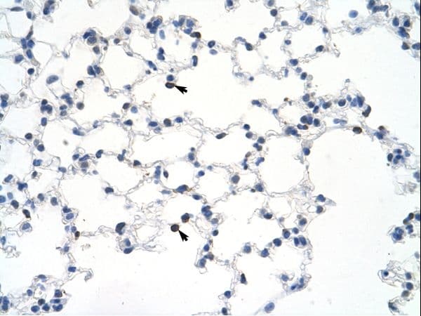 Polyclonal Rabbit anti-Mouse MYBBP1A Antibody (aa1201-1250, IHC, WB)