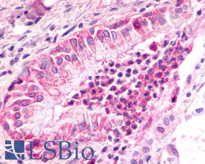 IHC-plus™ CXCR2 Antibody (N-Terminus)