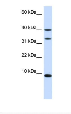 DBI / ACBD1 Antibody (N-Terminus)