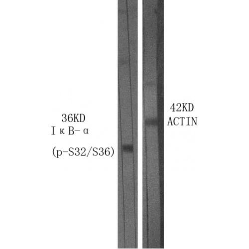 Polyclonal Rabbit anti-Human NFKBIA / IKB Alpha / IKBA Antibody (10-90 aa, IHC, IF, WB)