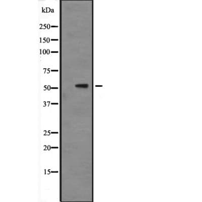 MAPK9 / JNK2 Antibody