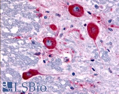PathPlus™ TAOK1 / TAO1 Antibody (Internal)
