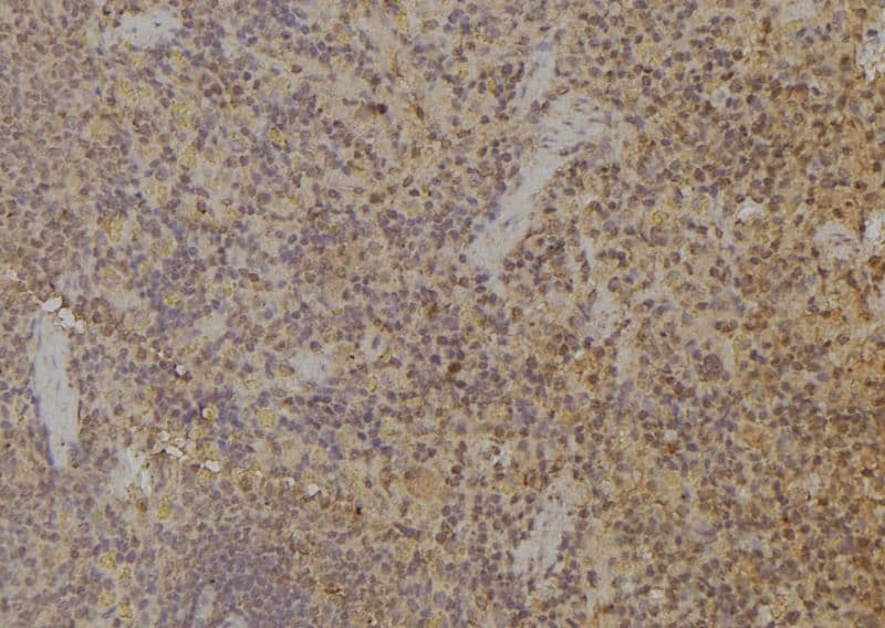 RCS / ARPP-21 Antibody