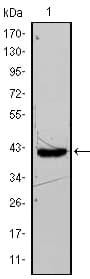 FABP4 / AP2 Antibody (clone 9B8D)
