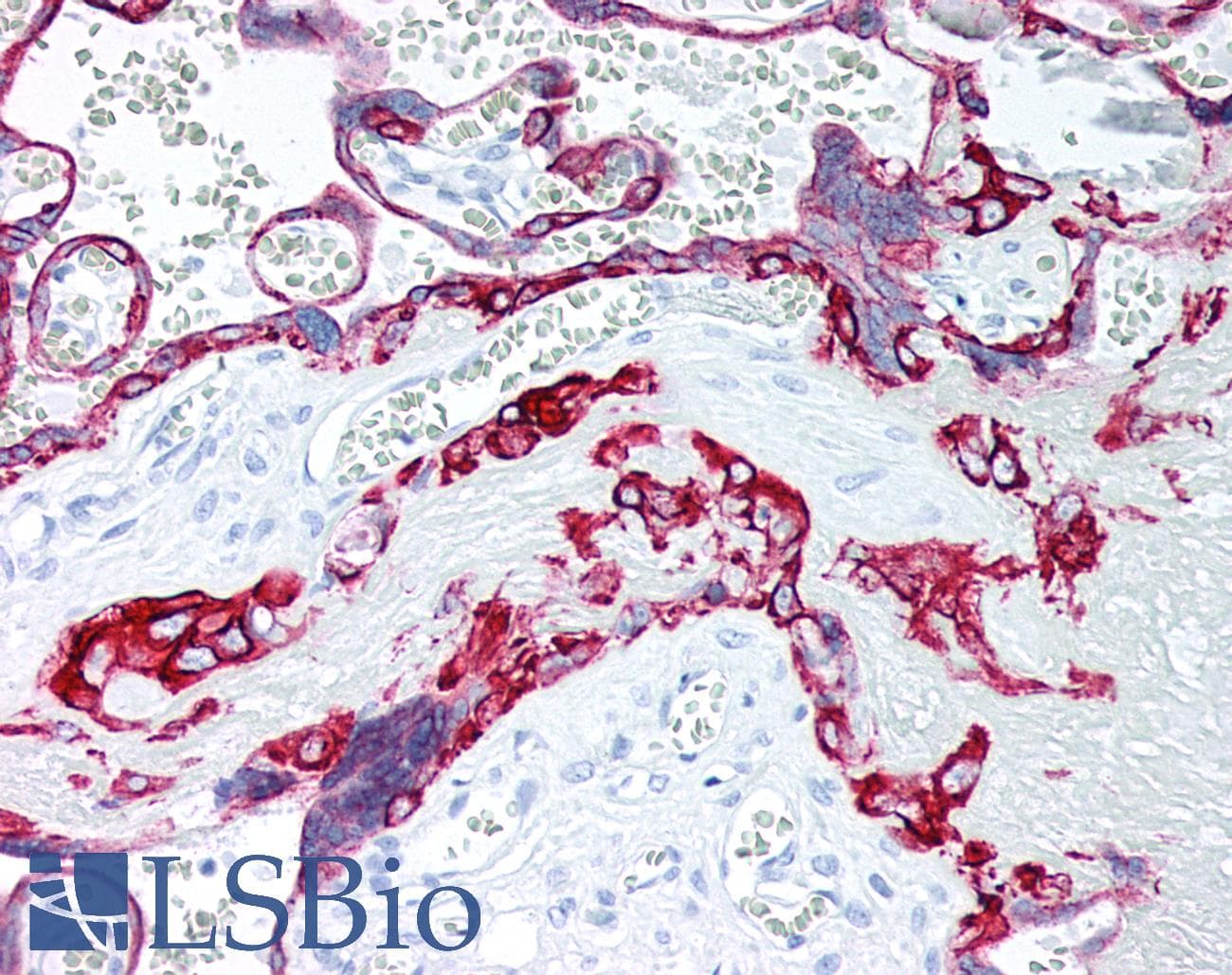 IHC-plus™ Monoclonal Mouse anti-Human KRT7 / CK7 / Cytokeratin 7 Antibody (clone ABT-CK7, IHC, WB)