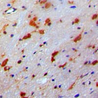PDRG1 Antibody (Internal)