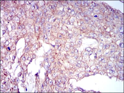 CLP / COTL1 Antibody (clone 5C8)