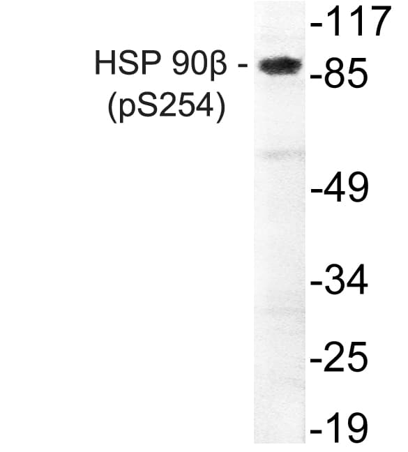 Polyclonal Rabbit anti-Human HSP90AB1 / HSP90 Alpha B1 Antibody (phospho-Ser254, IHC, WB)