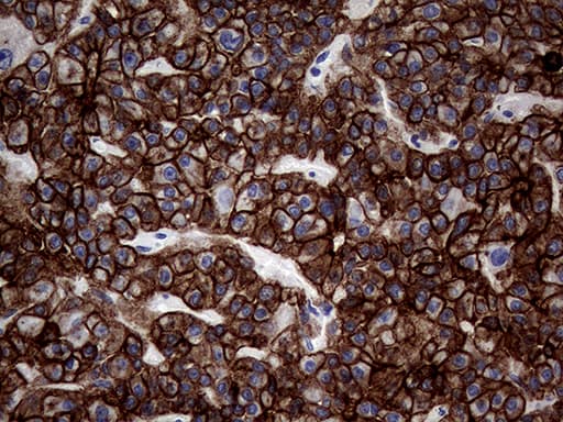 KRT18 / CK18 / Cytokeratin 18 Antibody (aa69-372, clone OTI10G8)