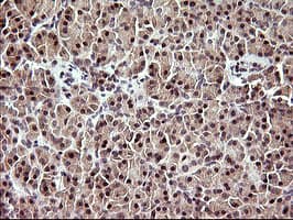 UPRT Antibody (clone OTI2D10)
