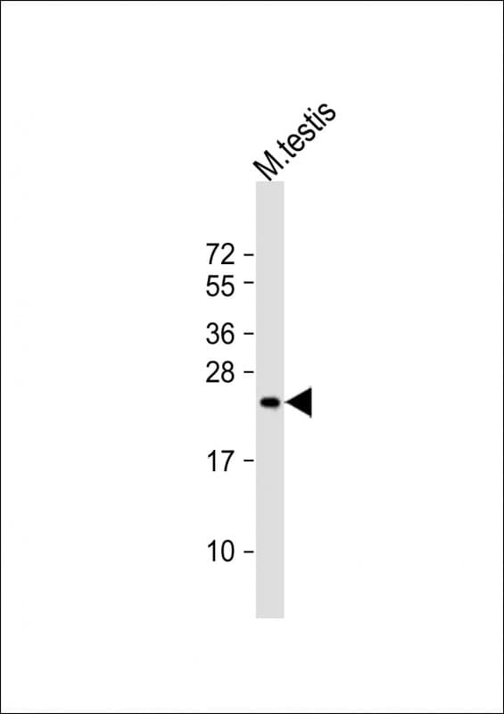 FEV / PET1 Antibody (aa53-86)