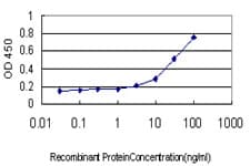 Monoclonal Mouse anti-Human ME1 / Malate Dehydrogenase Antibody (clone 3H5, IHC, WB)