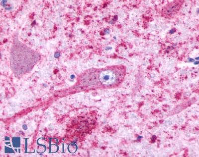 PathPlus™ Polyclonal Rabbit anti-Human HTR4 / 5-HT4 Receptor Antibody (Cytoplasmic Domain, IHC)