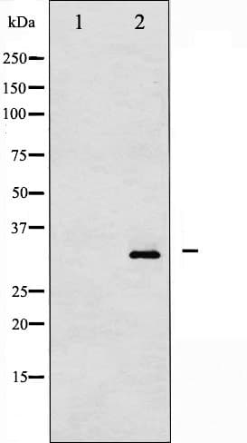 PPP1R1B / DARPP-32 Antibody (phospho-Thr34)