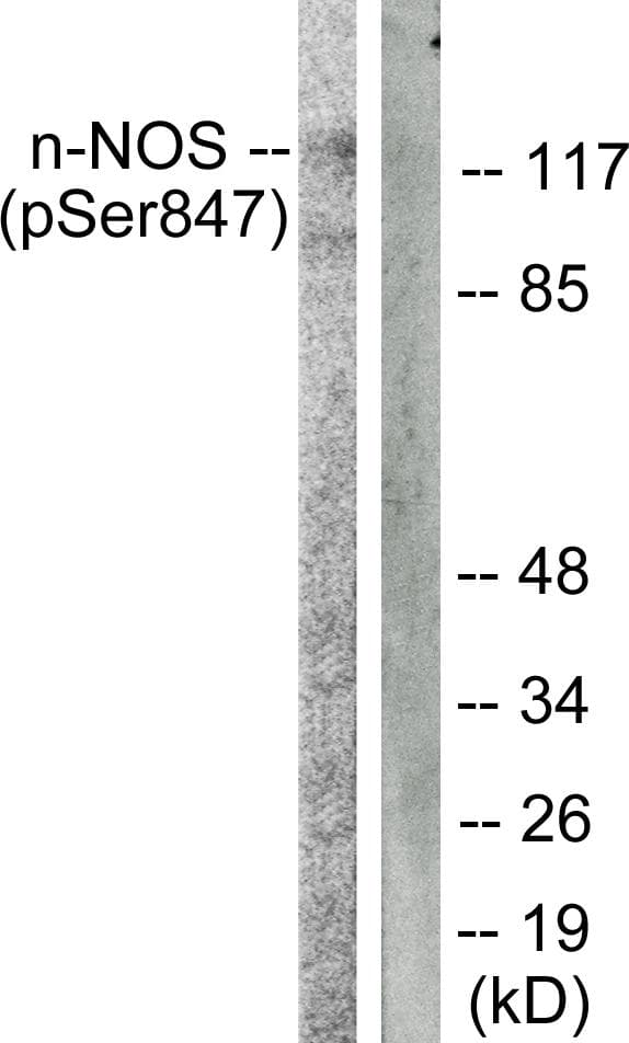 NOS1 / nNOS Antibody (phospho-Ser852)