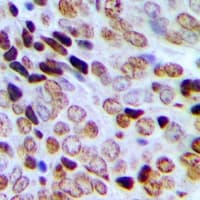 SRSF8 Antibody (Internal)