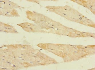Polyclonal Rabbit anti-Human FBXO40 Antibody