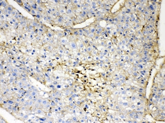 GNB1 Antibody