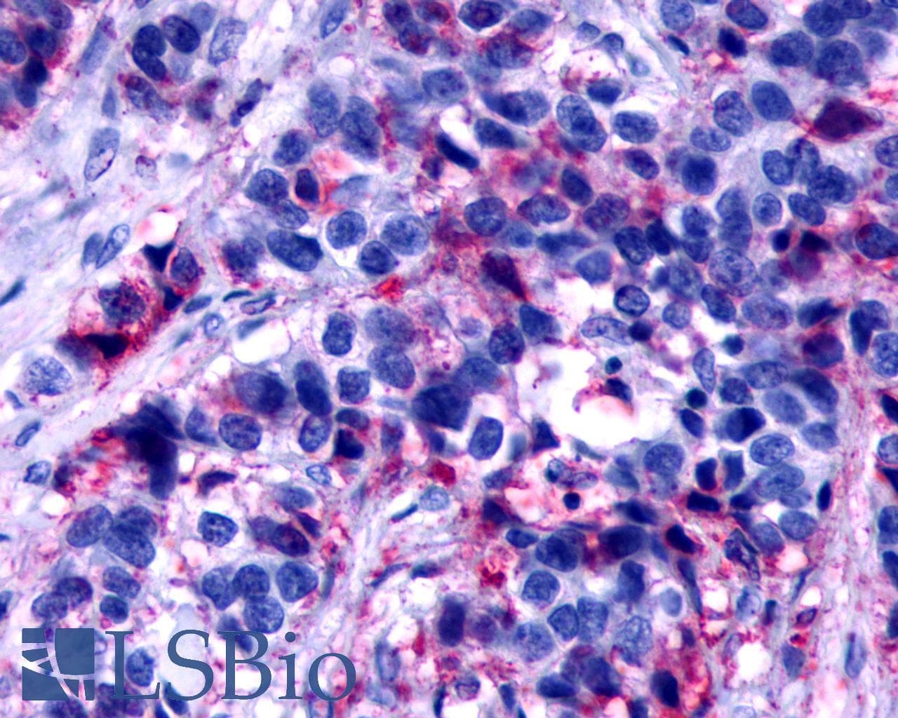 IHC-plus™ Polyclonal Rabbit anti-Human F2RL2 / PAR3 Antibody (C-Terminus, IHC)