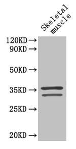 Polyclonal Rabbit anti-Human TNNT2 / CTNT Antibody (WB)