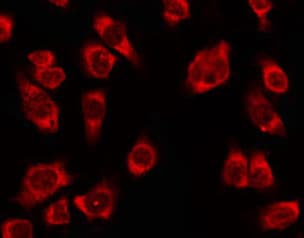 OR4K2 Antibody