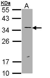ERCC1 Antibody