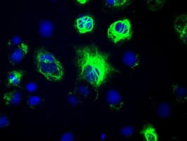 Monoclonal Mouse anti-Human GFAP Antibody (clone OTI1E11, IF, WB)
