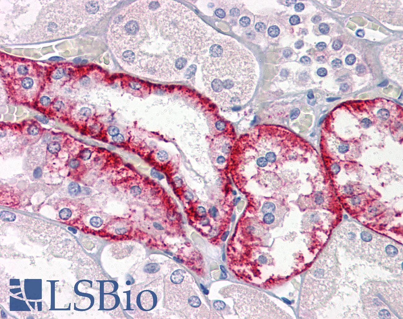 IHC-plus™ CTSK / Cathepsin K Antibody (clone 2F1)