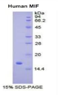 Human MIF Protein (Recombinant His)
