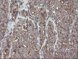 METAP2 Antibody (clone OTI1F6)