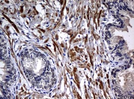 HSPD1 / HSP60 Antibody (clone OTI1B3)