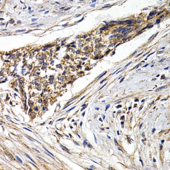 Polyclonal Rabbit anti-Human FZR1 Antibody (IHC, IF, WB)