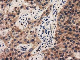 Monoclonal Mouse anti-Human PYCRL Antibody (clone OTI1B12, IHC, IF, WB)