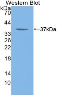 MYHC / MYH6 Antibody (aa856-1116)