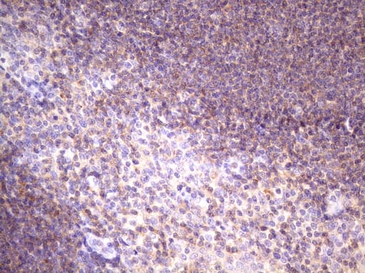 Monoclonal Mouse anti-Human FBXO8 / FBX8 Antibody (clone OTI3C5, Carrier-free, aa1-231, IHC, WB)