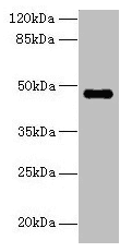 Polyclonal Rabbit anti-Human ZNF821 Antibody (IHC, WB)