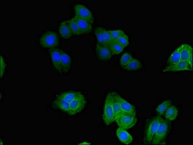 Polyclonal Rabbit anti-Human SNX17 Antibody (IHC, IF, WB)