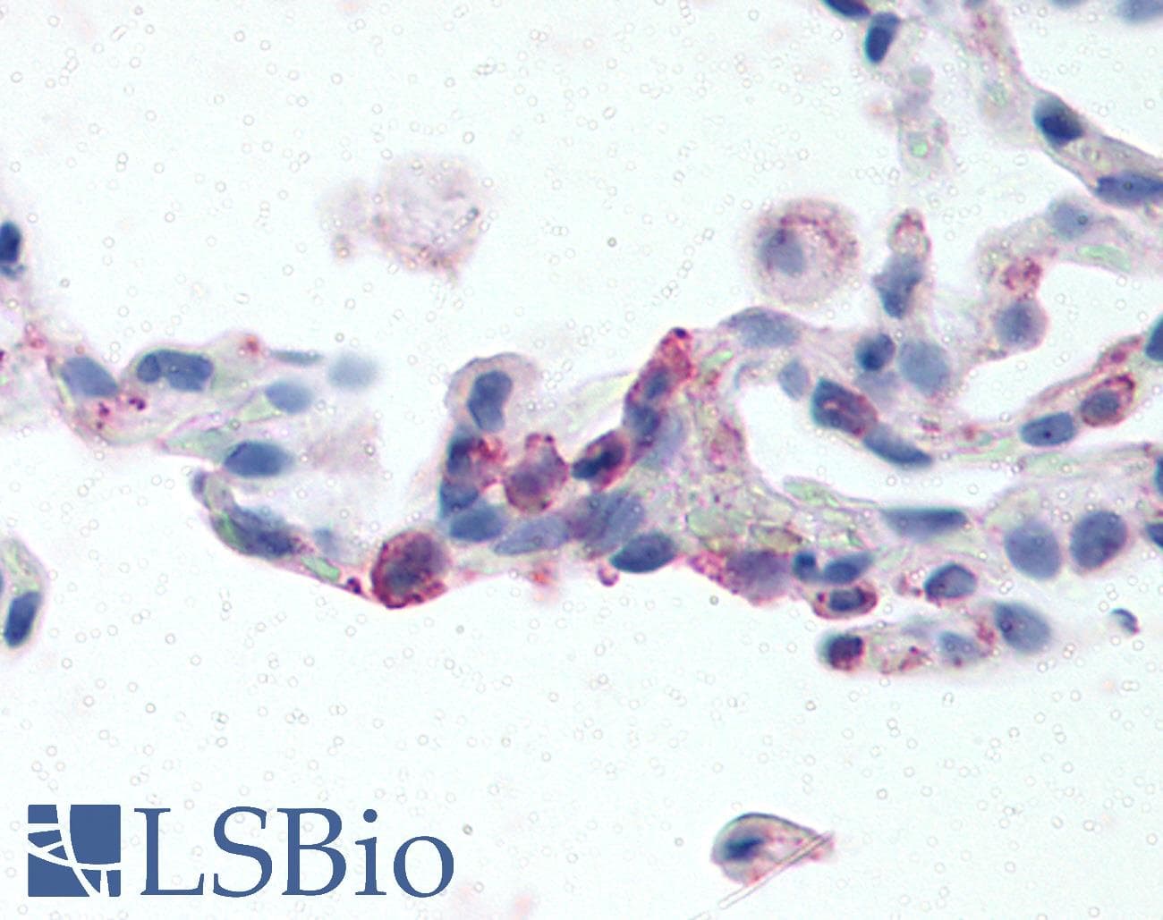 IHC-plus™ ADGRE2 / EMR2 Antibody (N-Terminus)