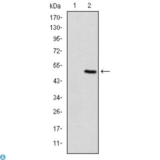 TNNI2 Antibody