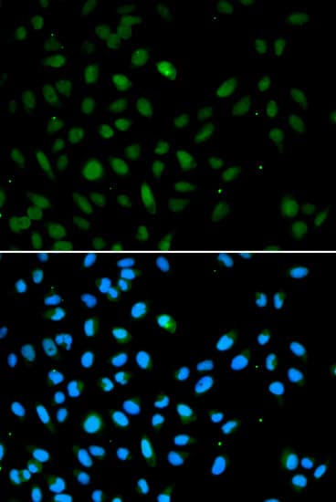 Polyclonal Rabbit anti-Human EZH1 / ENX-2 Antibody (IHC, IF, WB)
