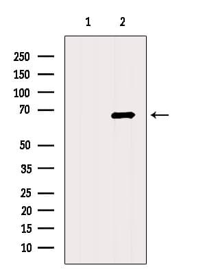 ACSM3 / SAH Antibody