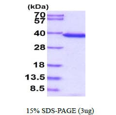 Human PPIE / Cyclophilin E Protein (Recombinant His)