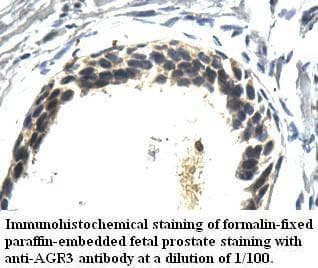 AG3 / AGR3 Antibody (aa22-165)
