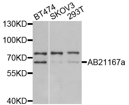 p58 / PSMD3 Antibody