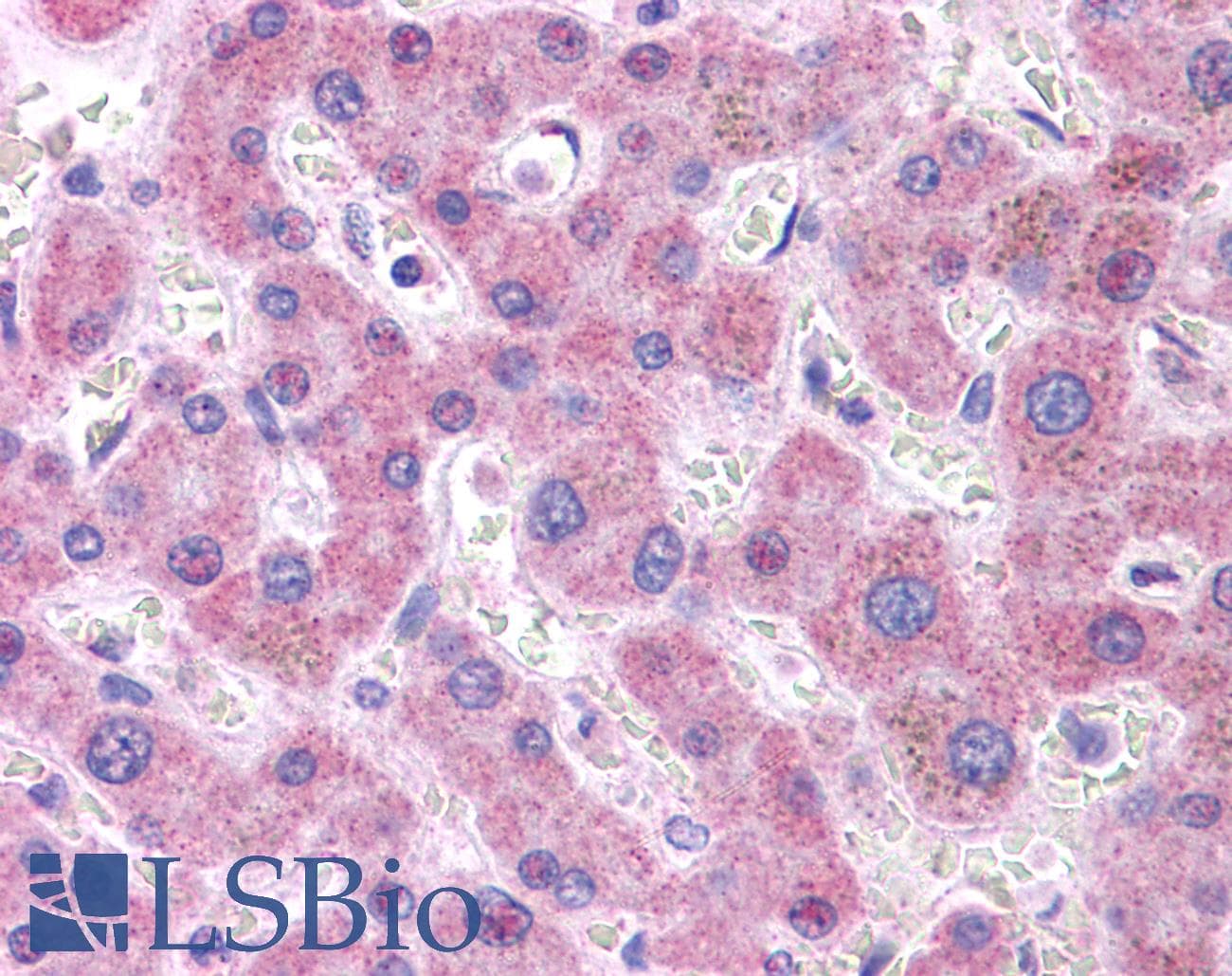 Polyclonal Rabbit anti-Human APOB / Apolipoprotein B Antibody (aa4031-4080, IHC, WB)