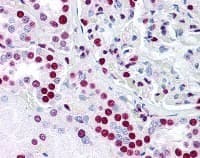 PTBP1 Antibody (clone 3H7)